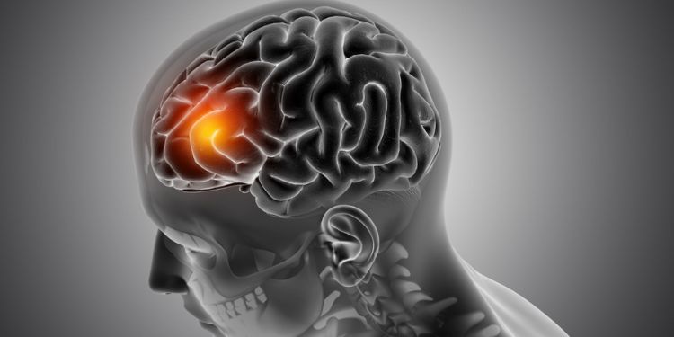 Article: Use of Stem Cell Growth and Differentiation Factors (Scdsf) in Central Vertigo 